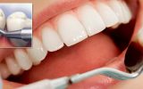 clinicii dentare Elveto Dent