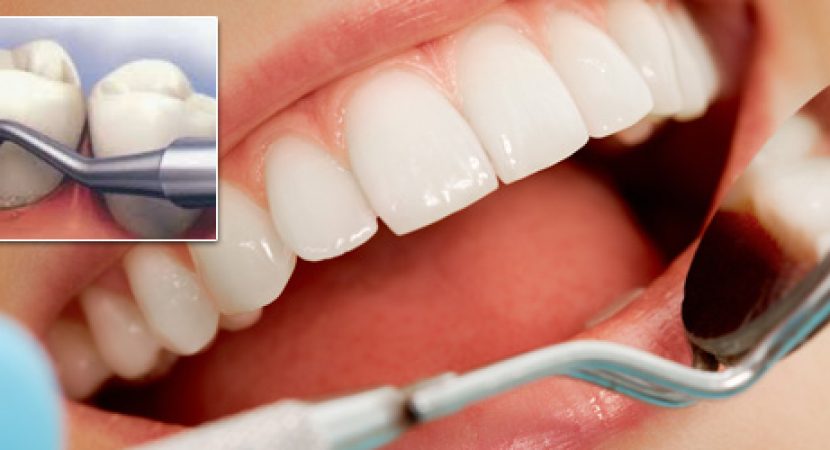clinicii dentare Elveto Dent
